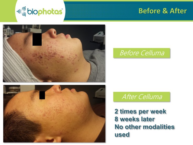 Before-After (3)