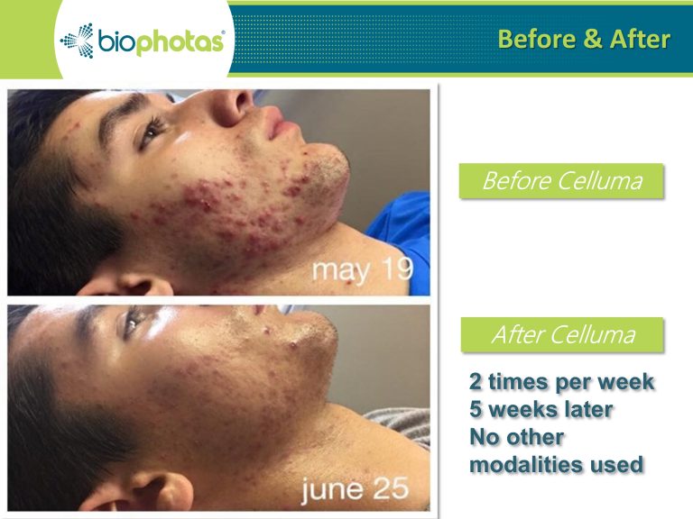 Before-After (5)