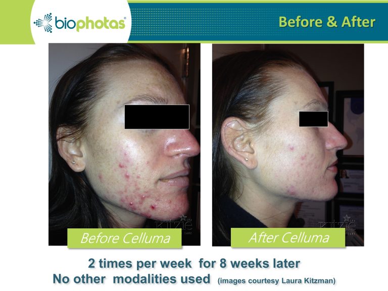 Before-After (6)
